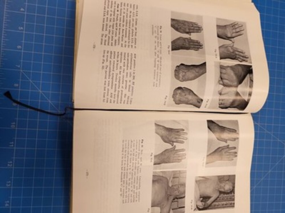 Causation Rheumatoid Disease Human Cancers Roger Wyburn-Mason Medicine Book - Picture 3 of 6